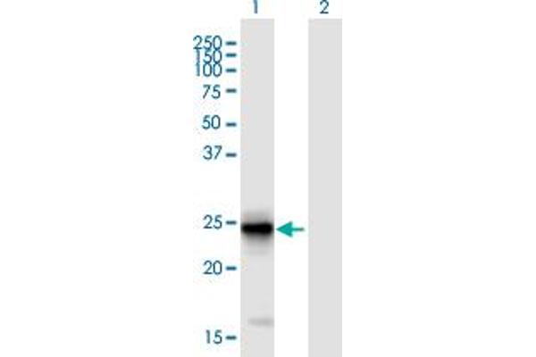 FIBIN anticorps  (AA 1-211)