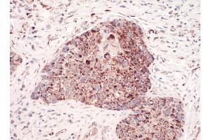 Immunohistochemistry (IHC) image for anti-Complement Component 1, Q Subcomponent Binding Protein (C1QBP) (AA 50-100) antibody (ABIN7454556) (C1QBP antibody  (AA 50-100))