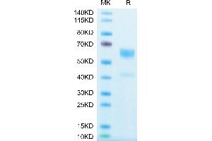 IL-9 Protein (AA 19-144) (Fc Tag)