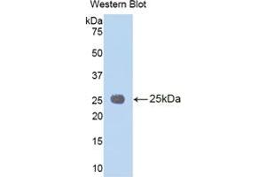 WB of Protein Standard: different control antibodies  against Highly purified E. (IL1RAP ELISA Kit)