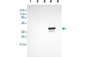 Western blot analysis of Lane 1: RT-4, Lane 2: EFO-21, Lane 3: A-431, Lane 4: Liver, Lane 5: Tonsil with OTC polyclonal antibody  at 1:250-1:500 dilution. (OTC antibody  (AA 172-299))