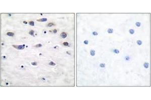 Immunohistochemistry analysis of paraffin-embedded human brain, using GluR1 (Phospho-Ser849) Antibody. (Glutamate Receptor 1 antibody  (pSer849))