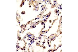 (ABIN390136 and ABIN2840640) staining P12 in human lung tissue sections by Iunohistochemistry (IHC-P - paraformaldehyde-fixed, paraffin-embedded sections). (MMP12 antibody  (C-Term))