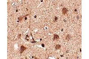 Immunohistochemistry (IHC) image for anti-SLIT and NTRK-Like Family, Member 5 (SLITRK5) (Middle Region 2) antibody (ABIN1031202) (SLITRK5 antibody  (Middle Region 2))