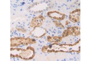 Used in DAB staining on fromalin fixed paraffin- embedded kidney tissue