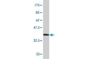 Western Blot detection against Immunogen (37. (LRRC2 antibody  (AA 272-371))