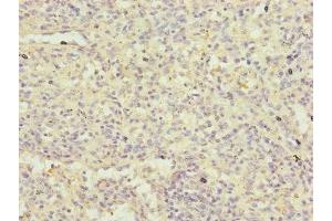 Immunohistochemistry of paraffin-embedded human spleen tissue using ABIN7152485 at dilution of 1:100 (FBXL5 antibody  (AA 1-310))