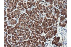 Image no. 3 for anti-Myeloid Leukemia Factor 1 (MLF1) antibody (ABIN1499493) (MLF1 antibody)