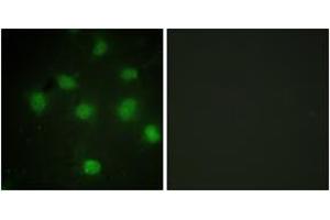 Immunofluorescence analysis of COS7 cells, using TLK1 (Ab-764) Antibody. (TLK1 antibody  (AA 730-779))