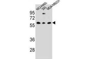 Western Blotting (WB) image for anti-C-Type Lectin Domain Family 17, Member A (CLEC17A) antibody (ABIN3000135) (CLEC17A antibody)