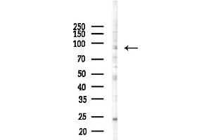 anti-Establishment of Cohesion 1 Homolog 1 (ESCO1) (Internal Region) antibody