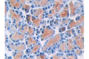 DAB staining on IHC-P; Samples: Rat Pancreas Tissue (Thymidine Phosphorylase antibody  (AA 33-290))