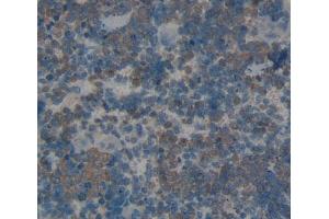 Used in DAB staining on fromalin fixed paraffin- embedded spleen tissue (SKAP1 antibody  (AA 1-354))