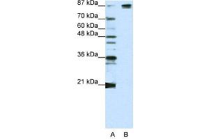 WB Suggested Anti-SF3B1  Antibody Titration: 1. (SF3B1 antibody  (Middle Region))