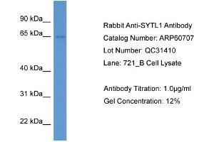 WB Suggested Anti-SYTL1  Antibody Titration: 0.