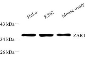 Western blot analysis of ZAR1 (ABIN7076290) at dilution of 1: 500 (Zygote Arrest 1 antibody)