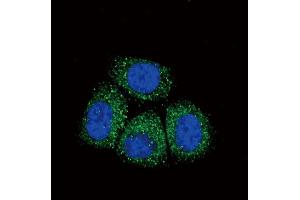 Confocal immunofluorescent analysis of SCNN1A Antibody (Center) (ABIN652752 and ABIN2842496) with Hela cell followed by Alexa Fluor? (SCNN1A antibody  (AA 365-391))