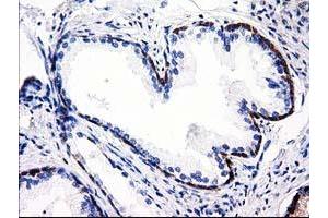 Immunohistochemical staining of paraffin-embedded Human Kidney tissue using anti-ALDH1L1 mouse monoclonal antibody. (ALDH1L1 antibody)
