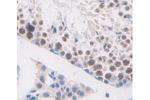 Used in DAB staining on fromalin fixed paraffin- embedded testis tissue (HMGB4 antibody  (AA 25-167))