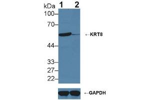 Knockout Varification: ;Lane 1: Wild-type Hela cell lysate; ;Lane 2: KRT8 knockout Hela cell lysate; ;Predicted MW: 54,57kDa ;Observed MW: 57kDa;Primary Ab: 2µg/ml Rabbit Anti-Human KRT8 Antibody;Second Ab: 0. (KRT8 antibody  (AA 92-393))