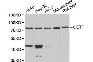 Western blot analysis of extracts of various cell lines, using CETP antibody. (CETP antibody  (AA 300-493))