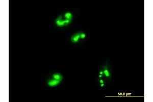 Immunofluorescence of monoclonal antibody to C1orf33 on HepG2 cell. (C1orf33 antibody  (AA 1-239))