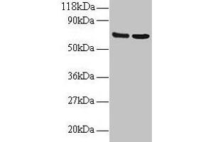 Western blot All lanes: IFITM1 antibody at 2 μg/mL Lane 1: EC109 whole cell lysate Lane 2: 293T whole cell lysate Secondary Goat polyclonal to rabbit IgG at 1/15000 dilution Predicted band size: 14 kDa Observed band size: 70 kDa (IFITM1 antibody  (AA 1-36))