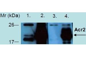Western Blotting analysis of recombinant protein Acr2 produced in Escherichia coli BL21 (lambdaDE3) transfected bacterial culture. (Acr2 - heat stress induced ribosome binding protein A antibody)