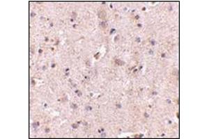 Immunohistochemistry of SAPAP2 in human brain with this product at 5 μg/ml. (DLGAP2 antibody  (Center))