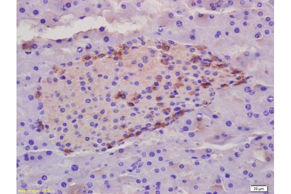 MORC2 antibody  (pSer739)