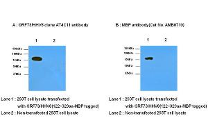 Western Blotting (WB) image for anti-Herpes Virus Type 8 (HHV8) (AA 122-329) antibody (ABIN371871) (HHV8 antibody  (AA 122-329))