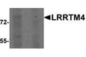 Western blot analysis of LRRTM4 in HeLa cell lysate with LRRTM4 antibody at 1 μg/ml in (left) the absence and (right) the presence of blocking peptide.