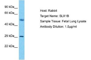 Host: Rabbit Target Name: SLX1B Sample Type: Fetal Lung lysates Antibody Dilution: 1. (SLX1A/GIYD2 antibody  (C-Term))