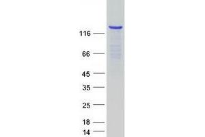 Validation with Western Blot (KDM4A Protein (Myc-DYKDDDDK Tag))