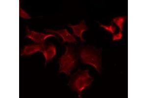 ABIN6275598 staining COLO205 by IF/ICC. (SLCO1B1 antibody)