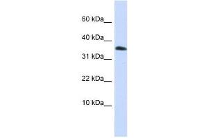 Western Blot showing EMX1 antibody used at a concentration of 1-2 ug/ml to detect its target protein. (EMX1 antibody  (Middle Region))