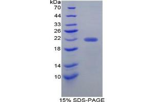 SDS-PAGE analysis of Mouse Ficolin 2 Protein. (Ficolin 2 Protein)