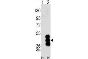 Western Blotting (WB) image for anti-phosphorylase Kinase, gamma 2 (Testis) (PHKG2) antibody (ABIN3003064) (PHKG2 antibody)