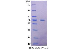 SDS-PAGE (SDS) image for Pentraxin 3 (PTX3) (AA 195-381) protein (His tag) (ABIN2126237)