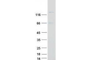 Validation with Western Blot (STK10-A Protein (Myc-DYKDDDDK Tag))