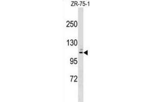 Western Blotting (WB) image for anti-Membrane-Associated Ring Finger (C3HC4) 10, E3 Ubiquitin Protein Ligase (MARCH10) antibody (ABIN2999509)