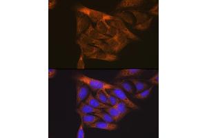 Immunofluorescence analysis of U2OS cells using VEGFR1 antibody (ABIN1683256, ABIN3015026, ABIN3015027 and ABIN6213602) at dilution of 1:100. (FLT1 antibody  (AA 1100-1200))