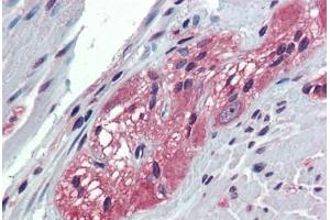 Anti-TXLNB antibody  ABIN1049448 IHC staining of human colon, ganglion cells. (Taxilin beta antibody  (Internal Region))