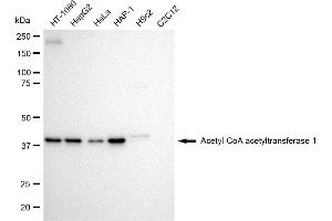 Western blotting analysis using Acetyl-CoA acetyltransferase 1 antibody (ABIN7797439). (Recombinant ACAT1 antibody)