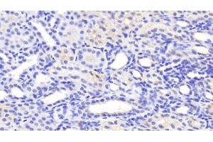 Detection of MFN1 in Human Kidney Tissue using Polyclonal Antibody to Mitofusin 1 (MFN1) (MFN1 antibody  (AA 1-227))
