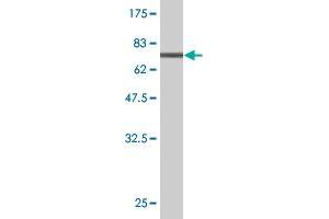 Western Blot detection against Immunogen (70. (CTH antibody  (AA 1-405))