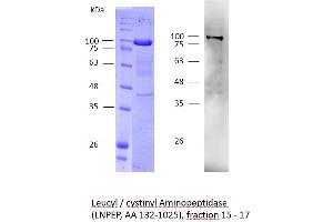 Image no. 2 for Leucyl/cystinyl Aminopeptidase (LNPEP) (AA 132-1025) protein (His tag) (ABIN3093476) (LNPEP Protein (AA 132-1025) (His tag))