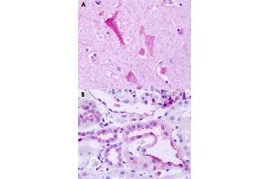 Immunohistochemical staining of formalin-fixed paraffin-embedded human brain, neurons (A) and human kidney (B) with GPR137B polyclonal antibody . (GPR137B antibody  (C-Term))
