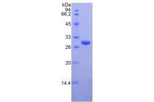 SDS-PAGE analysis of Mouse IRAK2 Protein. (IRAK2 Protein)