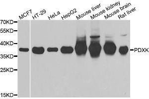 Western blot analysis of extracts of various cell lines, using PDXK antibody (ABIN5974032) at 1/1000 dilution. (PDXK antibody)